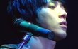 ✖✖✖정용화 피부상태 최악이네✖✖✖