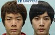 남자도성형해야하는구나ㅋㅋ(before&after)