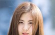 여드름 고치고 용된 연예인 모음! 