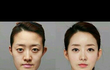 성형 사진ㅠ