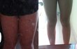 다이어트후기ㄷㄷ사진잇음