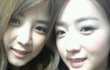 에이핑크 윤보미 성형?