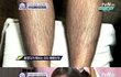 화성인X파일 "털복숭이녀" 여자가 털이 이렇게 많아..