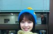 설리 앞트임