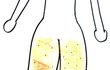 지방흡입하고 싶을 때ㅋㅋㅋㅋㅋㅋㅋ