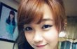 정은지 성형 총정리