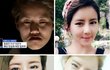렛미인4 웃음을 잃어버린 딸 윤단비씨의 대박 변신