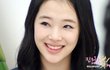 설리눈꼬리 아이라인길이만큼 앞트임 쌍수 눈매교정 베란다확장 