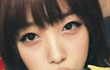 설리 앞트임흉터