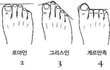 당신의 발은 어떤 타입입니까.jpg