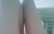 다리 좀 봐주세요
