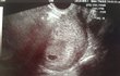 [10/26 기념] 2014년 파란코트녀&폭풍매너남 근황