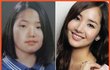 볼때마다 놀라는 성형계의 신화 미녕이 언니