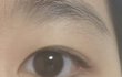 쌍수할까요말까요?