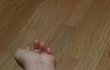팔목에 자해 흔적 잠시 보이지 않게 하기 (사진 첨부)