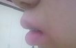 교정후기(라지만 사실 하소연)