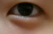 쌍수할까요ㅠ