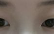 나쌍수할까말까ㅠㅠ 추반좀..