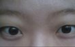 쌍수고민이요 