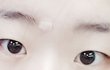 쌍수할까요말까요 사진잇어요