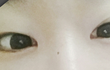 엄마가 강제로 쌍수ㅜㅜㅜㅜㅜㅜ