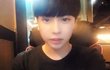 페북스타겸 아이돌 김용진 보톡스맞음?