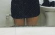 다리 모양이 이상해요..