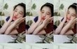 수정)아이유성형