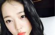 입술 부르튼 설리