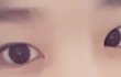 제눈사시?사팔인가요?(사진)