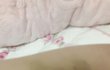 친구한테 맞아서 이케됨ㅋㅋㅋㅋㅋㅋㅋㅋㅋ..