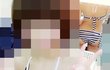페북에 노출사진올리는애