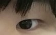 성형 결심 후 후기 잘된거 맞아? (추가)