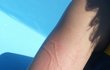 신혼여행중에.... 꼭 좀 조언부탁드립니다ㅠㅠ (혐오사진주의!!)