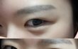 쌍수 한지 5년 됨