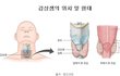** 예방 불가능한 갑상선 질환 ! 정기 검진이 해답이다! ** 