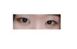 2주전에 쌍수했어 후기!(약혐)
