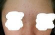 또)추가)사진있음)피부 많이 좋아졌지?