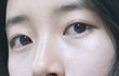 수지얼굴에