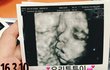 +주작아니야우리튼튼이맞아)나 임신했어 글쓰니인데