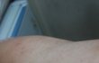 고시텔에 생긴 벌레문제 제 책임인가요? -- 2번째