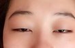 [주목] 여러분 쌍꺼풀이 이렇게 중요합니다