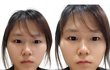 얼평 및 성형 견적 부탁드립니다