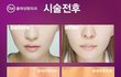 얘들아 뷰티 유투버 회사원 코성형함