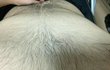 몸에 털이 너무많아서 고민입니다...