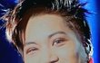 엑소 카이 쌍수 부작용으로 망가진 얼굴