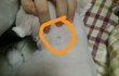 강아지 몸에 난거 뭔가요?