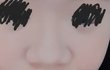 코성형 고민 입니다 좀 봐주세요