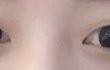 쌍수고민중이에요 봐주세용!ㅜ