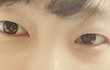 나 쌍수 필요한 눈인지 봐줘 ㅠㅠ